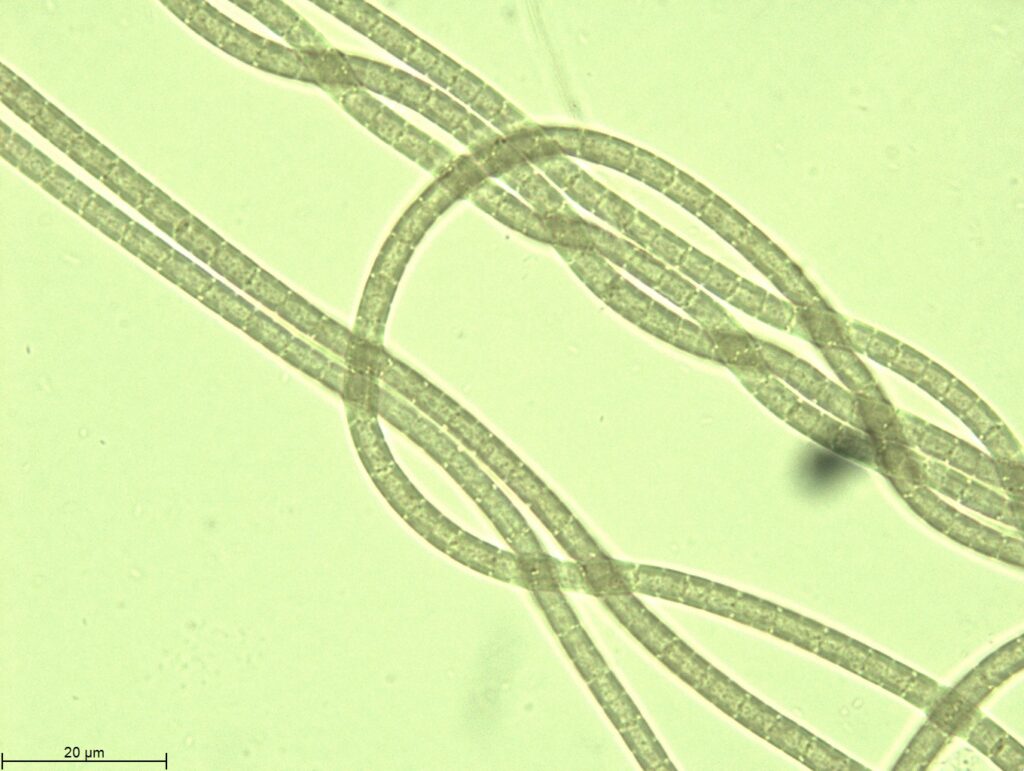 cianobacterias_Image057_ch00
